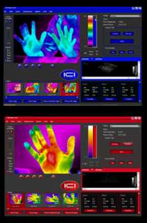 ETI Pro Medical FDA Cleared Infrared Thermal Camera  