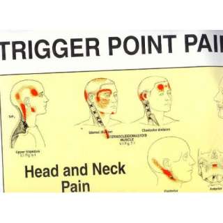  Trigger Points of Pain: Wall Charts (Set of 2 