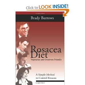  Rosacea Diet A Simple Method to Control Rosacea 