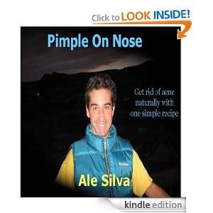 Pimple On Nose How I cured my acne from the inside out Ale Silva 